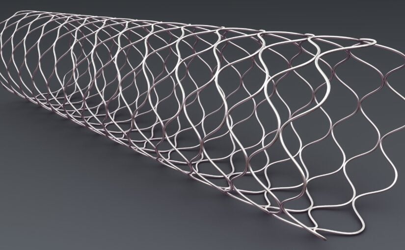Modeling Shape Memory Alloys with Ansys Mechanical Software​