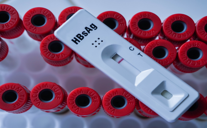 Capillary Flow in a Blood Testing Cassette: Microfluidics Application