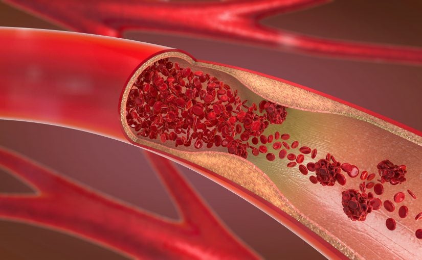 3D Bifurcating Artery