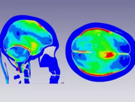 2020-11-brain-strain-figure.png